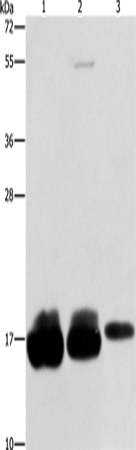 Anti-Human IFITM3 Antibody - ABMIUM