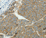 Anti-Human SLC16A1 Antibody - ABMIUM