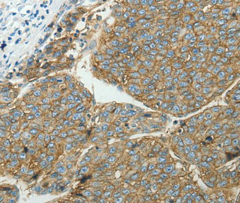 Anti-Human SLC16A1 Antibody - ABMIUM