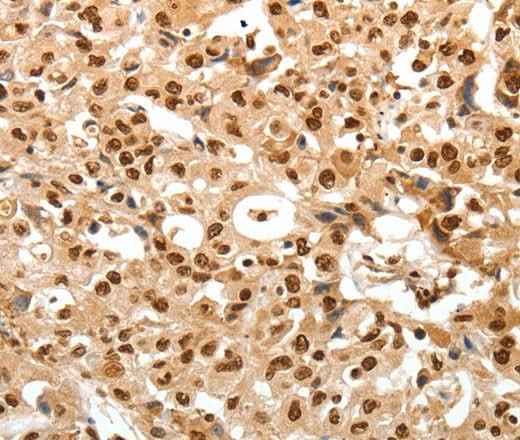 Anti-Human TNXB Antibody