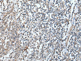 Immunohistochemistry of paraffin-embedded Human tonsil tissue using DEFB104A Polyclonal Antibody at dilution of 1:50(×200)