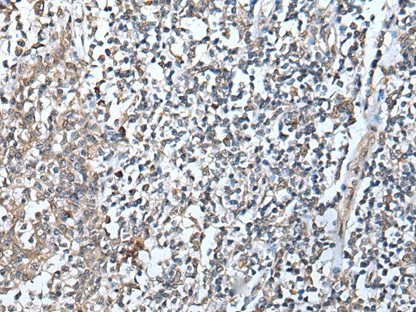 Immunohistochemistry of paraffin-embedded Human tonsil tissue using DEFB104A Polyclonal Antibody at dilution of 1:50(×200)