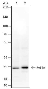 Anti-Human/Mouse Rab9A Antibody [A349]