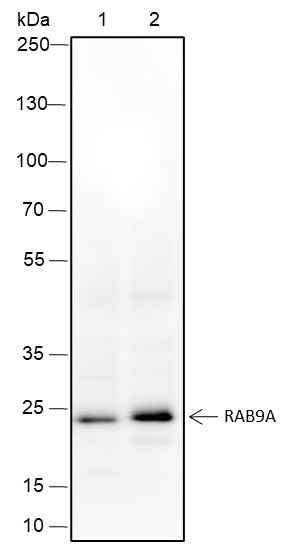 Anti-Human/Mouse Rab9A Antibody [A349]