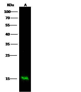 Anti-Human S100A9 Antibody [A1191] - ABMIUM