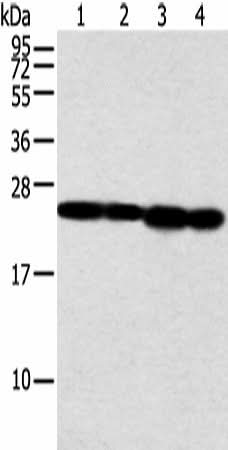 Western blot analysis of Jurkat and A549 cell human fetal liver tissue and hela cell using NDUFB9 Polyclonal Antibody at dilution of 1:350