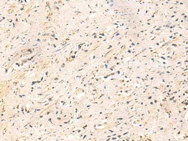 Anti-Human IP6K3 Antibody
