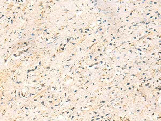 Anti-Human IP6K3 Antibody