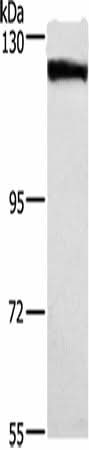 Anti-Human/Mouse DSG1 Antibody - ABMIUM