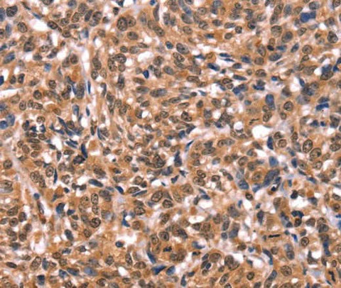 Anti-Human ESRRB Antibody - ABMIUM