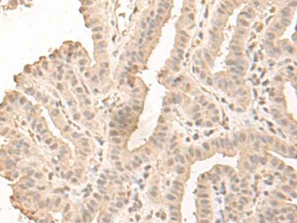 Anti-Human/Mouse SAP130 Antibody