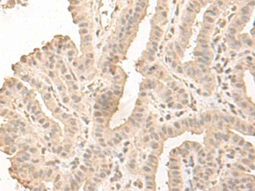 Anti-Human/Mouse SAP130 Antibody