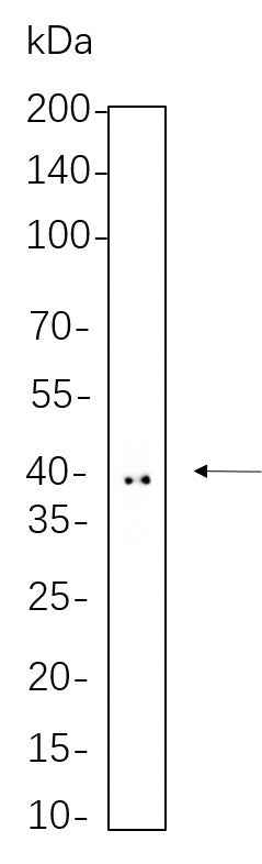 Anti-Human/Mouse/Rat Doublecortin Antibody [B1063] - ABMIUM