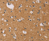 Anti-Human CD22 Antibody - ABMIUM