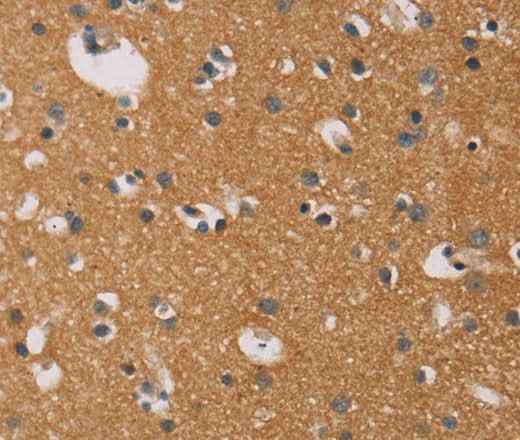 Anti-Human CD22 Antibody