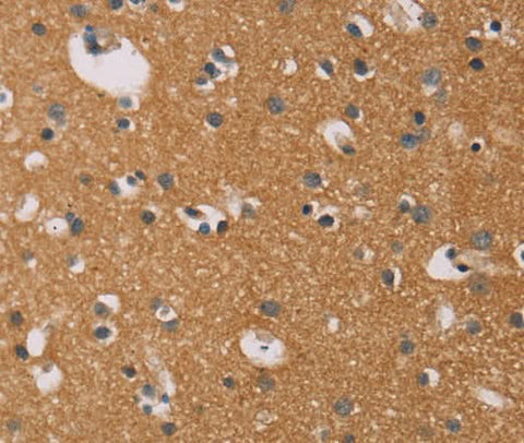 Anti-Human CD22 Antibody - ABMIUM