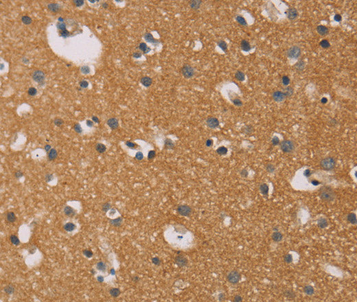 Anti-Human CD22 Antibody - ABMIUM