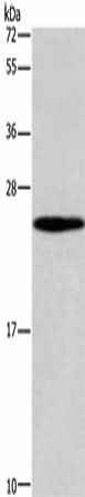 Anti-Human/Mouse GUK1 Antibody