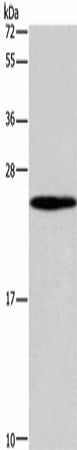 Anti-Human/Mouse GUK1 Antibody - ABMIUM