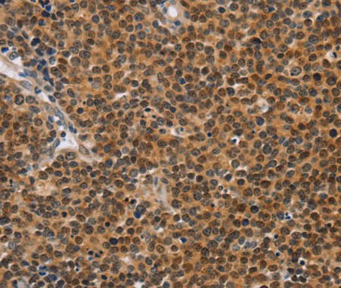 Anti-Human CD36 Antibody - ABMIUM