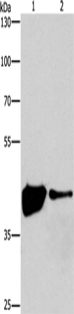 Anti-Human MAPK11 Antibody - ABMIUM