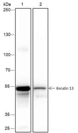 Anti-Human Keratin 13 Antibody [A402]