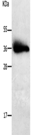 Anti-Human/Mouse/Rat PLPP1 Antibody - ABMIUM