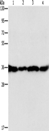 Anti-Human/Mouse/Rat GNB1 Antibody - ABMIUM