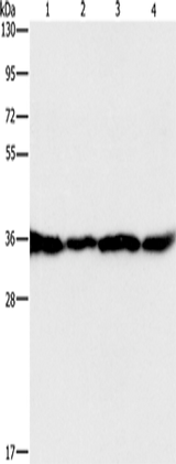 Anti-Human/Mouse/Rat GNB1 Antibody - ABMIUM