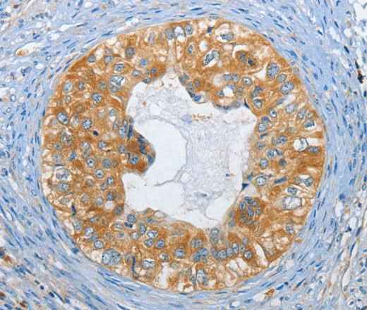 Anti-Human/Mouse/Rat DGKZ Antibody