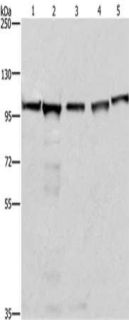 Anti-Human/Mouse/Rat MCM6 Antibody - ABMIUM