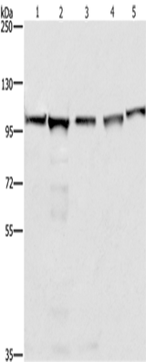 Anti-Human/Mouse/Rat MCM6 Antibody - ABMIUM