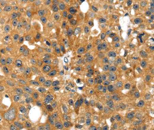 Anti-Human SMYD4 Antibody