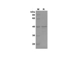 SDS-PAGE analysis of Human DAO proteins, 2 μg/lane of Recombinant Human DAO proteins, was resolved with SDS-PAGE under reducing conditions, showing bands at 40 kDa.