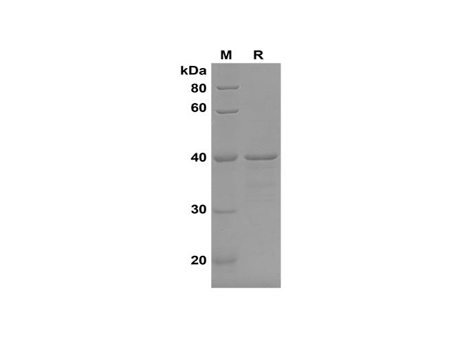SDS-PAGE analysis of Human DAO proteins, 2 μg/lane of Recombinant Human DAO proteins, was resolved with SDS-PAGE under reducing conditions, showing bands at 40 kDa.