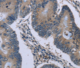 Anti-Human/Mouse/Rat Connexin 47 Antibody - ABMIUM