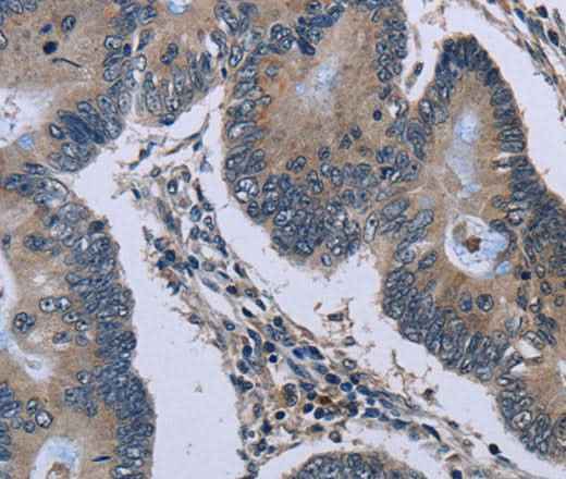 Anti-Human/Mouse/Rat Connexin 47 Antibody