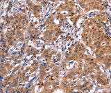Anti-Human/Mouse/Rat GCG Antibody - ABMIUM