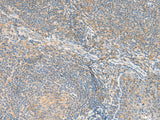 Immunohistochemistry of paraffin-embedded Human tonsil tissue using RNF207 Polyclonal Antibody at dilution of 1:80(×200)