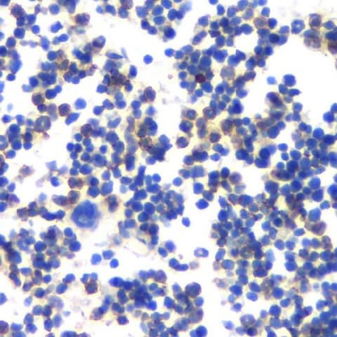 mmunohistochemistry analysis of paraffin-embedded mouse bone using MMP13 Polyclonal Antibody at dilution of 1:200.