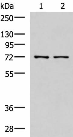 Western blot analysis of Mouse liver tissue and Jurkat cell lysates using MKS1 Polyclonal Antibody at dilution of 1:700