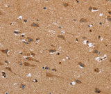 Anti-Human/Mouse/Rat NDRG3 Antibody - ABMIUM