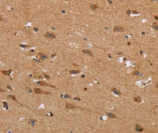 Anti-Human/Mouse/Rat NDRG3 Antibody