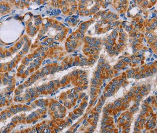 Anti-Human/Mouse ALG9 Antibody