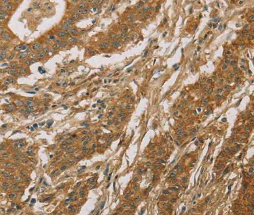Anti-Human CYP39A1 Antibody