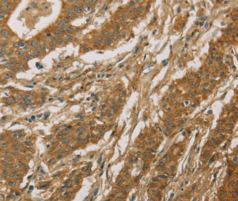 Anti-Human CYP39A1 Antibody - ABMIUM