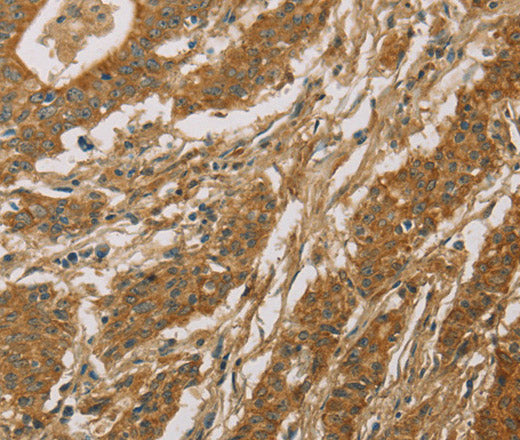 Anti-Human CYP39A1 Antibody - ABMIUM