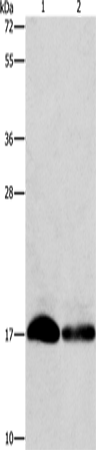 Anti-Human IFITM3 Antibody - ABMIUM