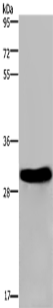 Anti-Human/Mouse/Rat FHL2 Antibody - ABMIUM