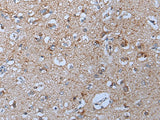 Immunohistochemistry of paraffin-embedded Human brain tissue using YPEL5 Polyclonal Antibody at dilution of 1:60(×200)